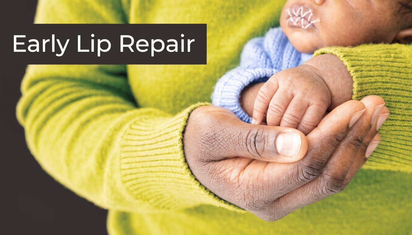 A gentle adult hand cradles the small hand of a newborn baby recovering from cleft lip surgery.