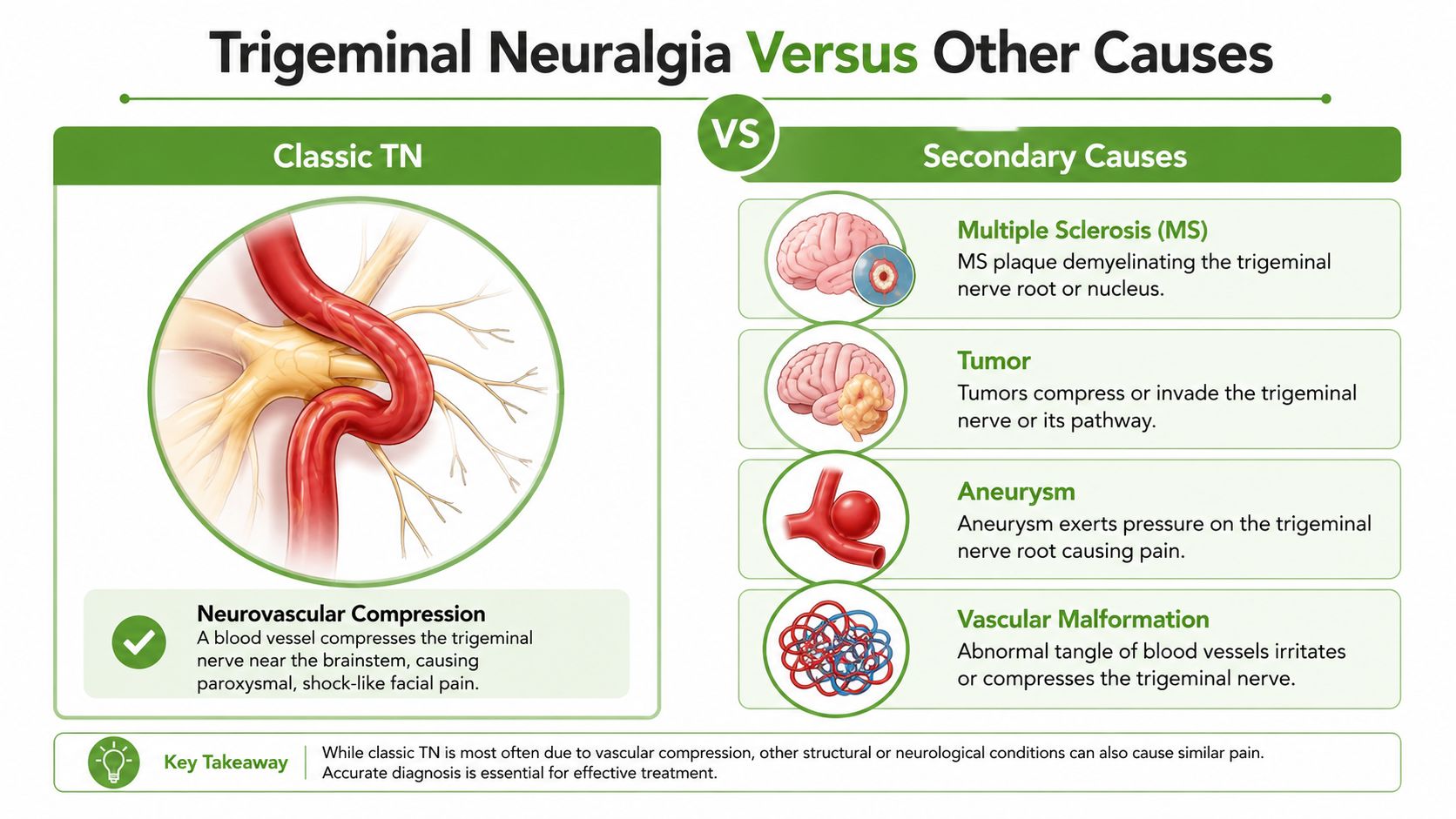 An infographic comparing classic trigeminal neuralgia caused by blood vessel compression to secondary causes like tumors or MS.