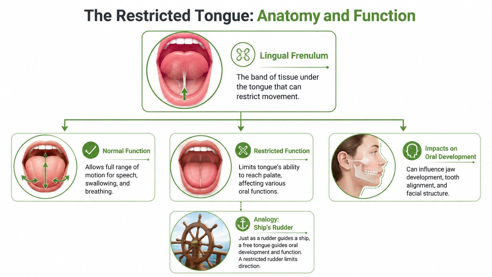An infographic showing the anatomy of a lingual frenulum and the effects of a restricted tongue.
